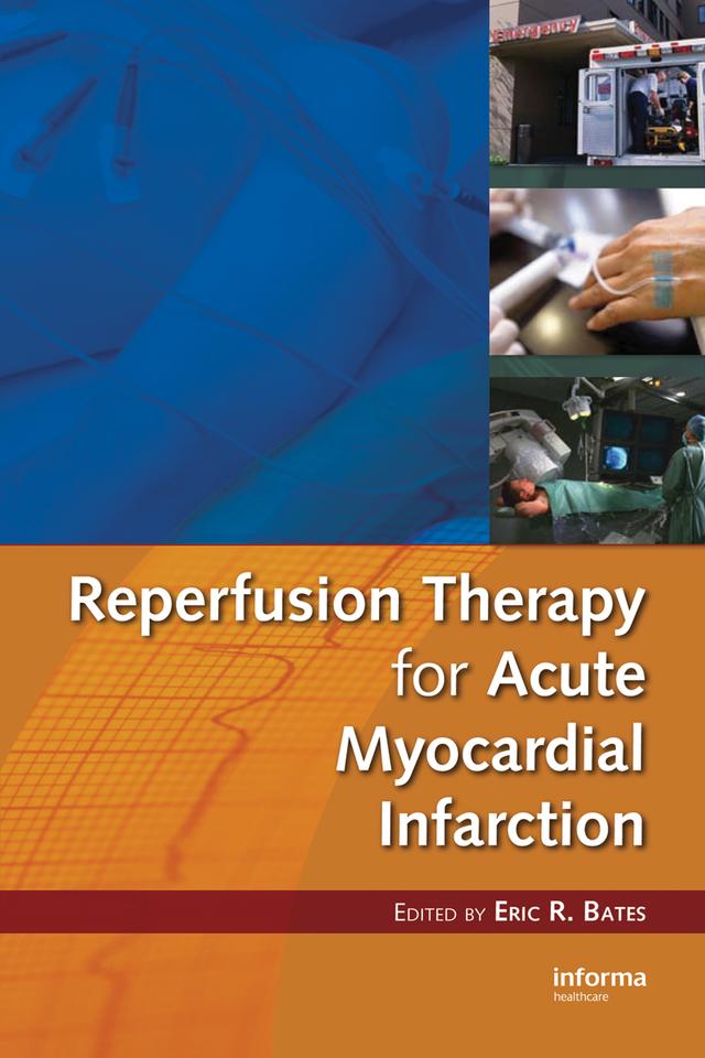 Reperfusion Therapy for Acute Myocardial Infarction by Eric R. Bates
