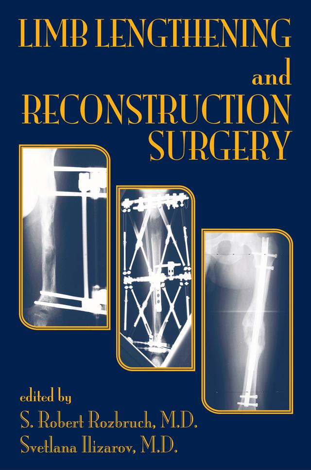 Limb Lengthening and Reconstruction Surgery by S. Robert Rozbruch, Svetlana Ilizarov