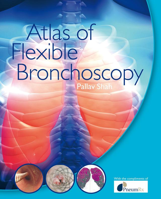 Atlas of Flexible Bronchoscopy by Pallav Shah