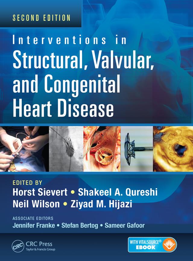 Interventions in Structural, Valvular and Congenital Heart Disease by Horst Sievert, Neil Wilson, Shakeel A. Qureshi, Ziyad M. Hijazi