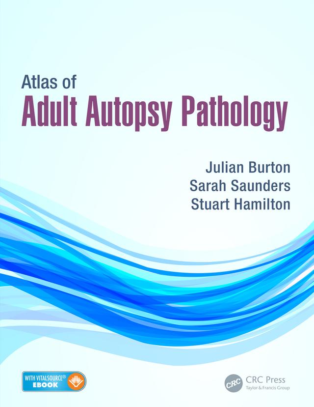 Atlas of Adult Autopsy Pathology by Julian Burton, Sarah Saunders, Stuart Hamilton