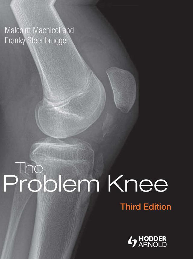 The Problem Knee by Franky Steenbrugge, Malcolm F. MacNicol, Malcolm Macnicol