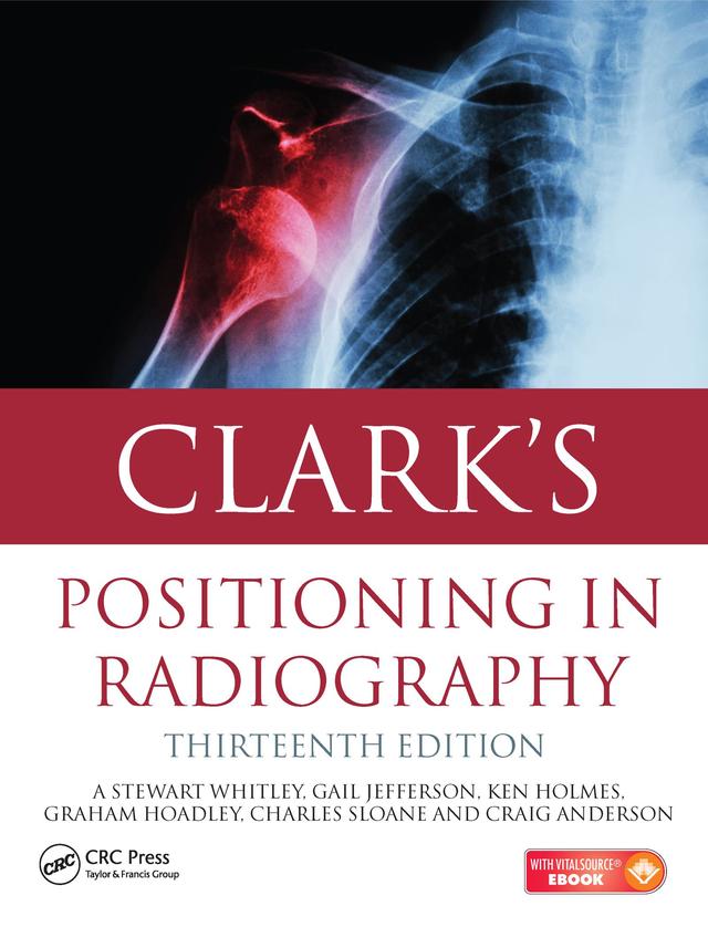 Clark's Positioning in Radiography 13E by A. Stewart Whitley, Charles Sloane, Craig Anderson, Gail Jefferson, Graham Hoadley, Ken Holmes