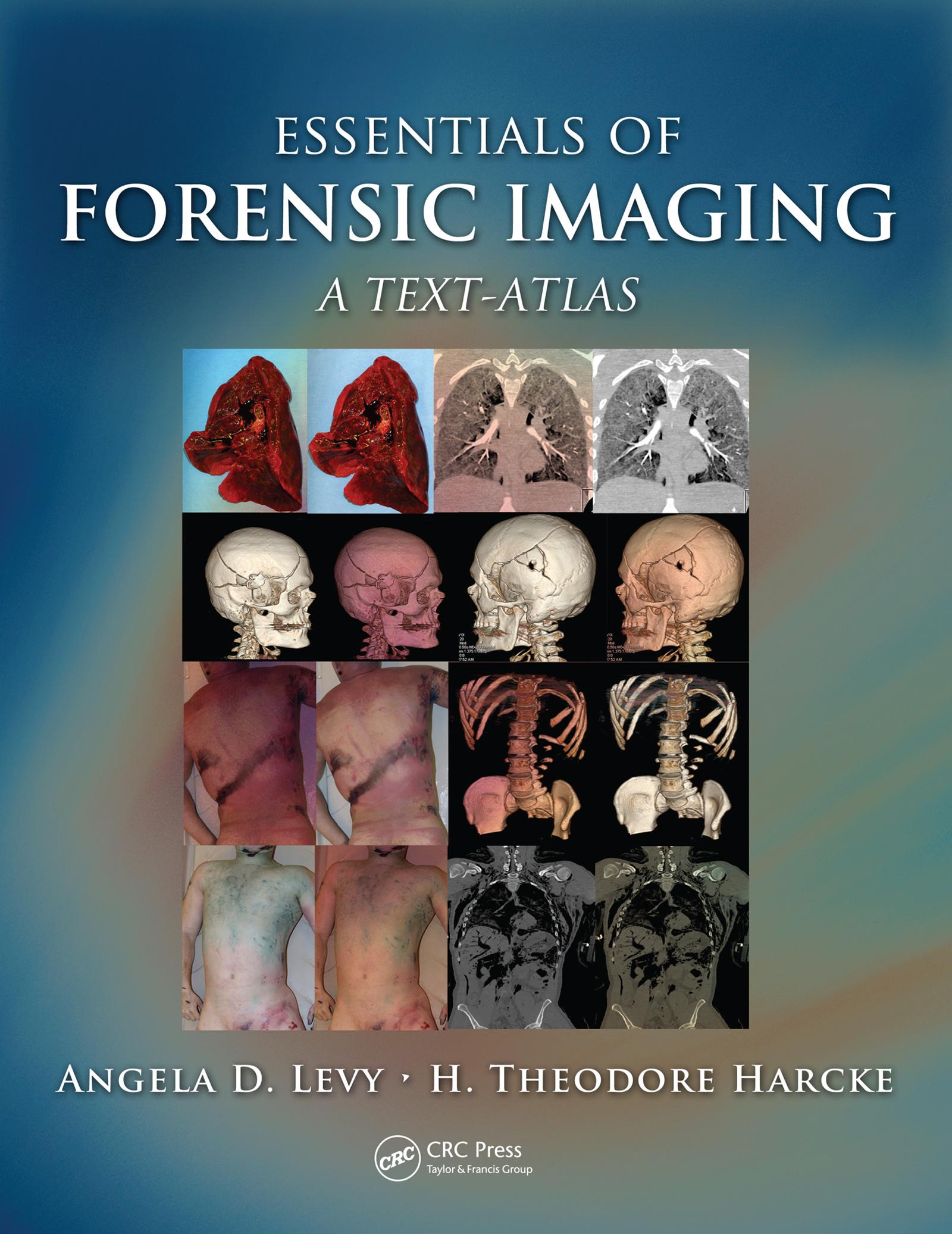Essentials of Forensic Imaging