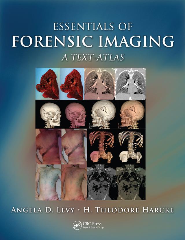 Essentials of Forensic Imaging by Angela D. Levy, H. Theodore Harcke, Jr.
