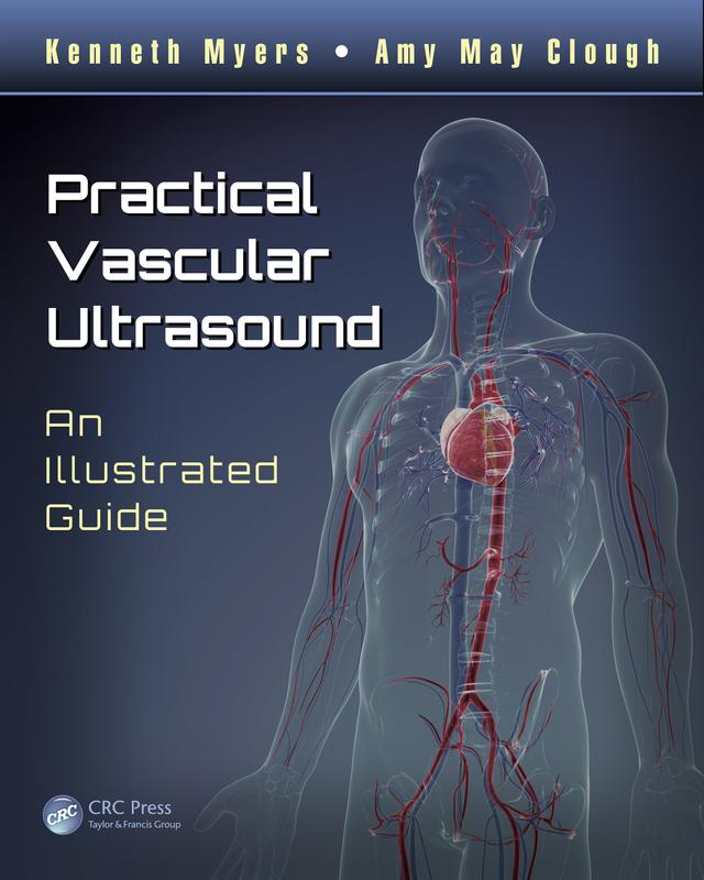 Practical Vascular Ultrasound by Amy May Clough, Kenneth Myers