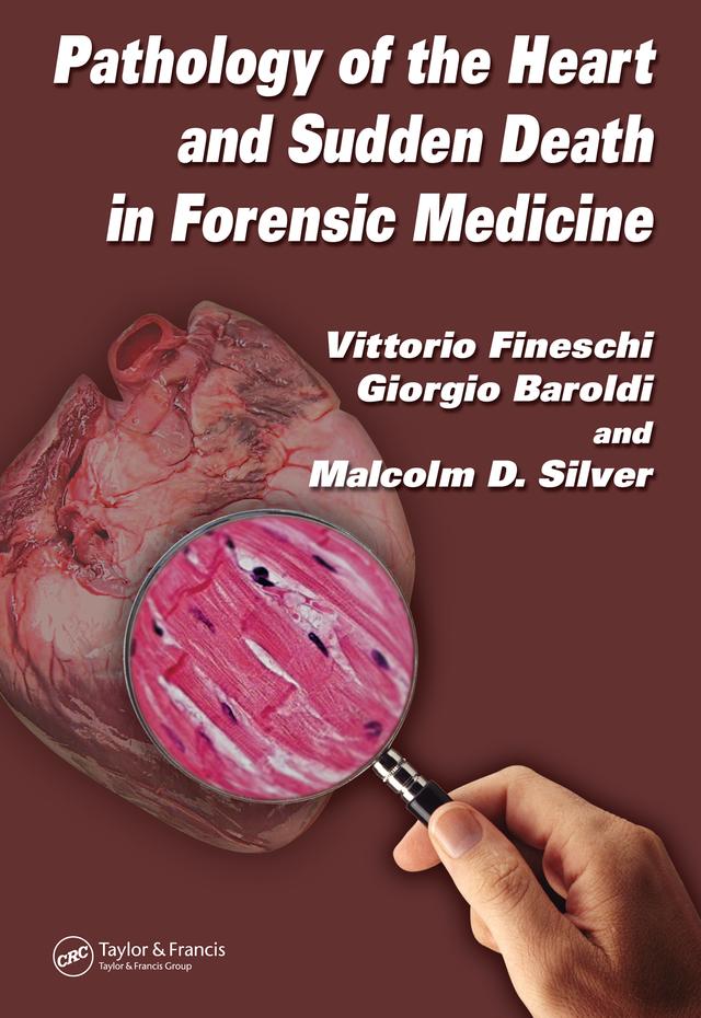 Pathology of the Heart and Sudden Death in Forensic Medicine by Giorgio Baroldi, Malcolm D. Silver, Vittorio Fineschi