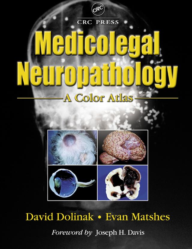 Medicolegal Neuropathology by David Dolinak, Evan W. Matshes