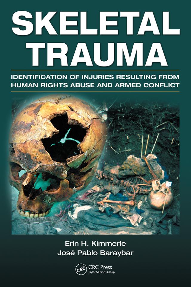 Skeletal Trauma by Erin H. Kimmerle, Jose Pablo Baraybar