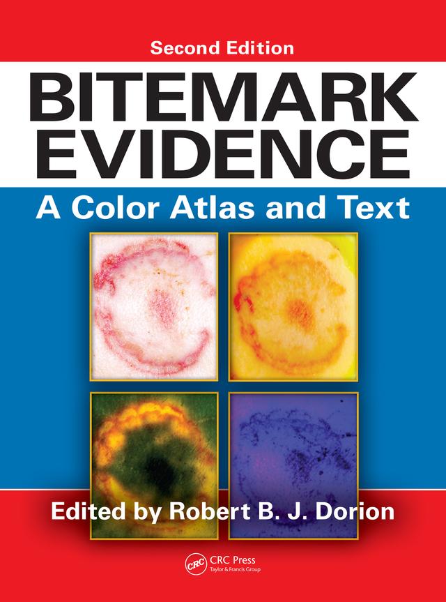 Bitemark Evidence by Robert B.J. Dorion