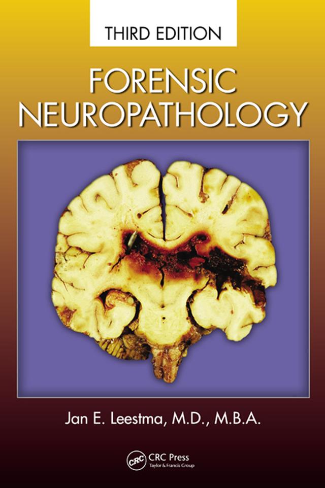 Forensic Neuropathology by Jan E. Leestma