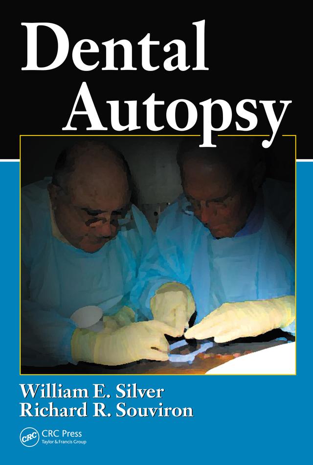Dental Autopsy by Richard R. Souviron, William E. Silver