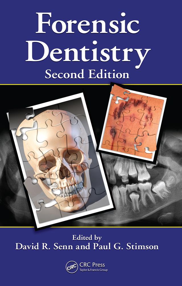 Forensic Dentistry by David R. Senn, Paul G. Stimson