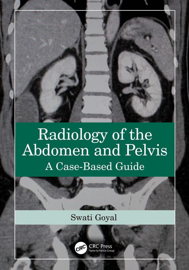 Radiology of the Abdomen and Pelvis by Swati Goyal