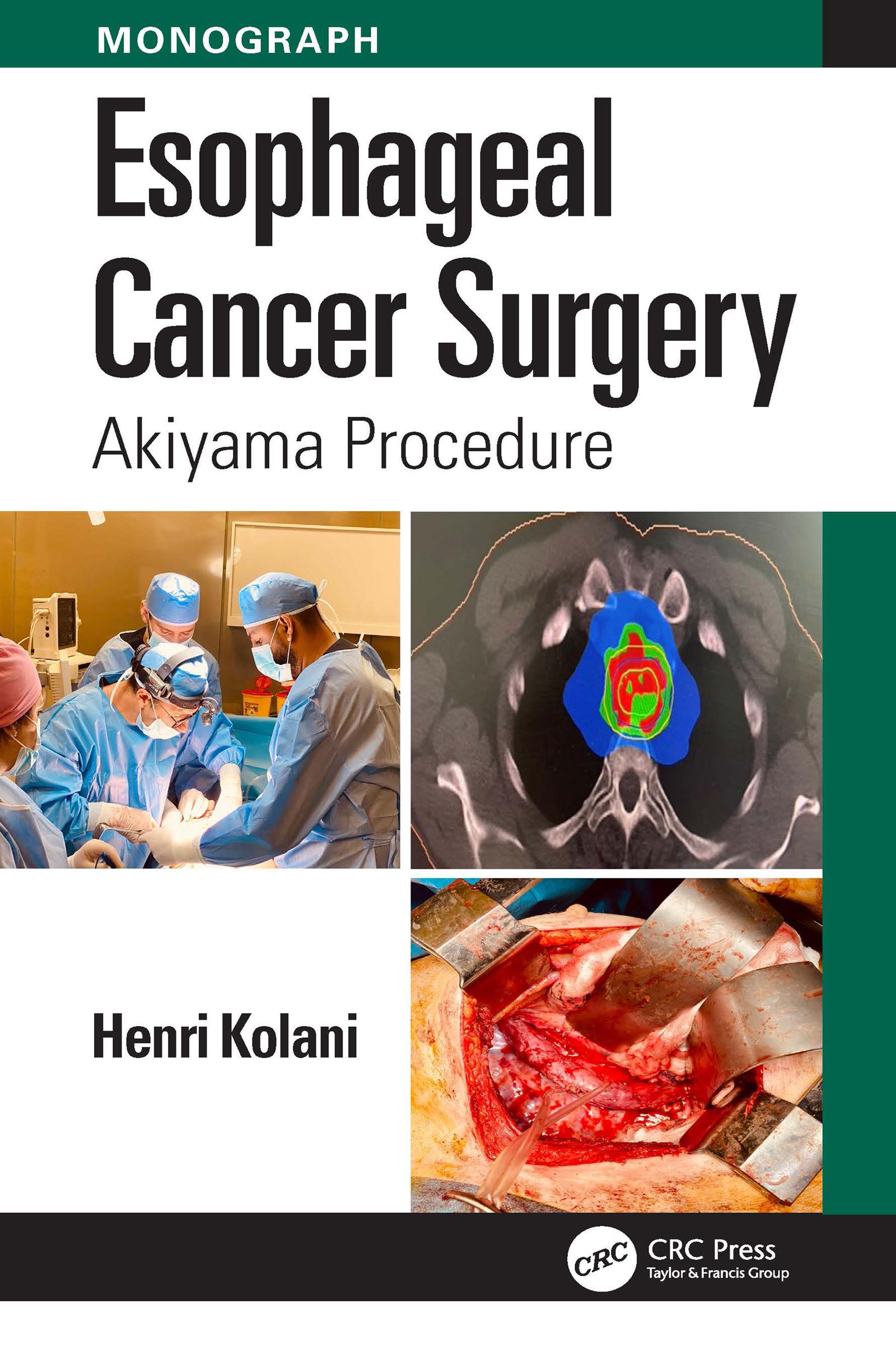 Esophageal Cancer Surgery