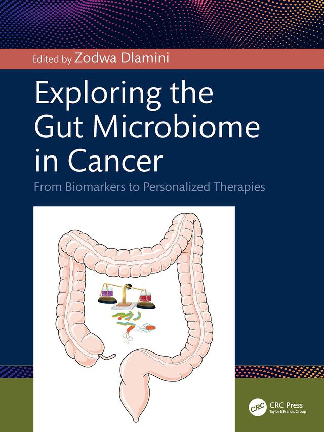 Exploring the Gut Microbiome in Cancer by Zodwa Dlamini