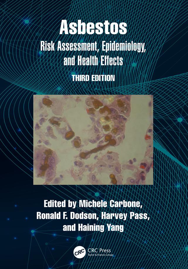 Asbestos by Haining Yang, Harvey Pass, Michele Carbone, Ronald Dodson