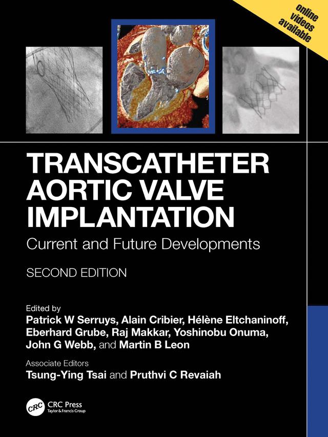 Transcatheter Aortic Valve Implantation by Alain Cribier, Eberhard Grube, Helene Eltchaninoff, John G. Webb, Martin B. Leon, Patrick W. Serruys, Raj Makkar, Yoshinobu Onuma