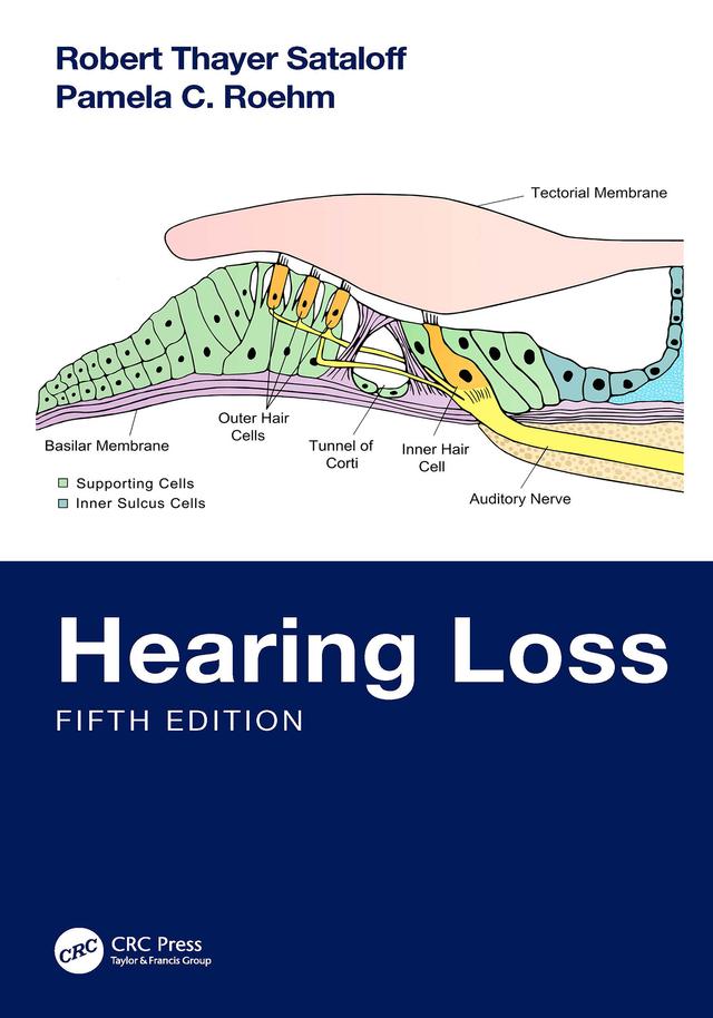 Hearing Loss by Pamela C. Roehm, Robert Thayer Sataloff