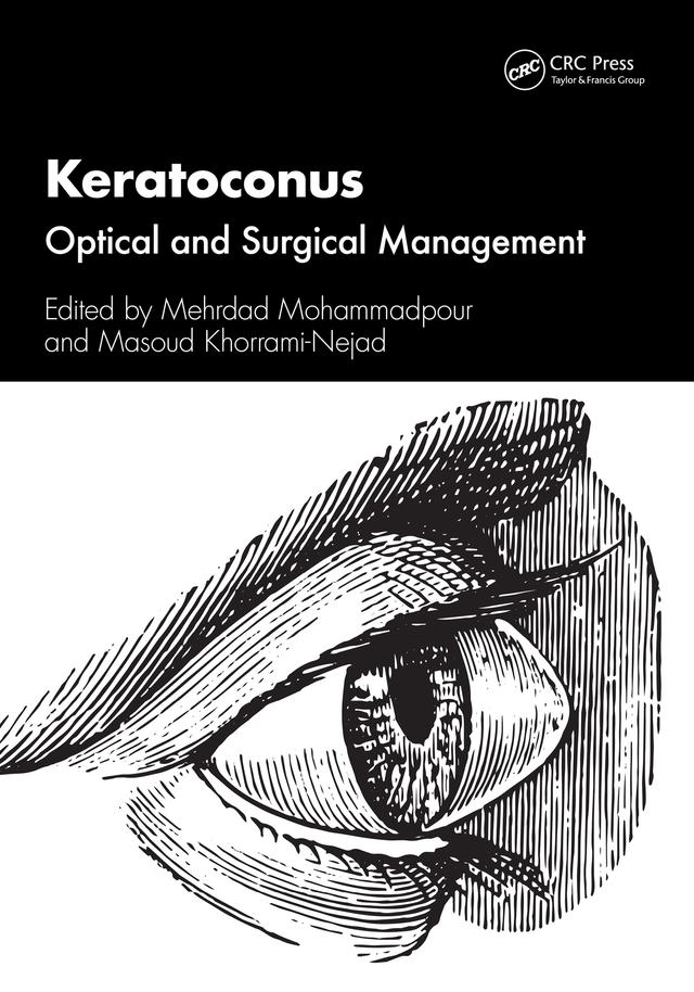 Keratoconus by Masoud Khorrami- Nejad, Mehrdad Mohammadpour