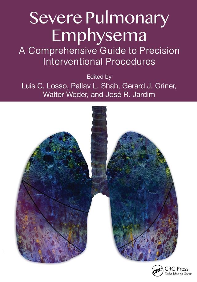 Severe Pulmonary Emphysema: by Gerald J. Criner, José R Jardim, Luis C. Losso, Pallav L. Shah, Walter Weder