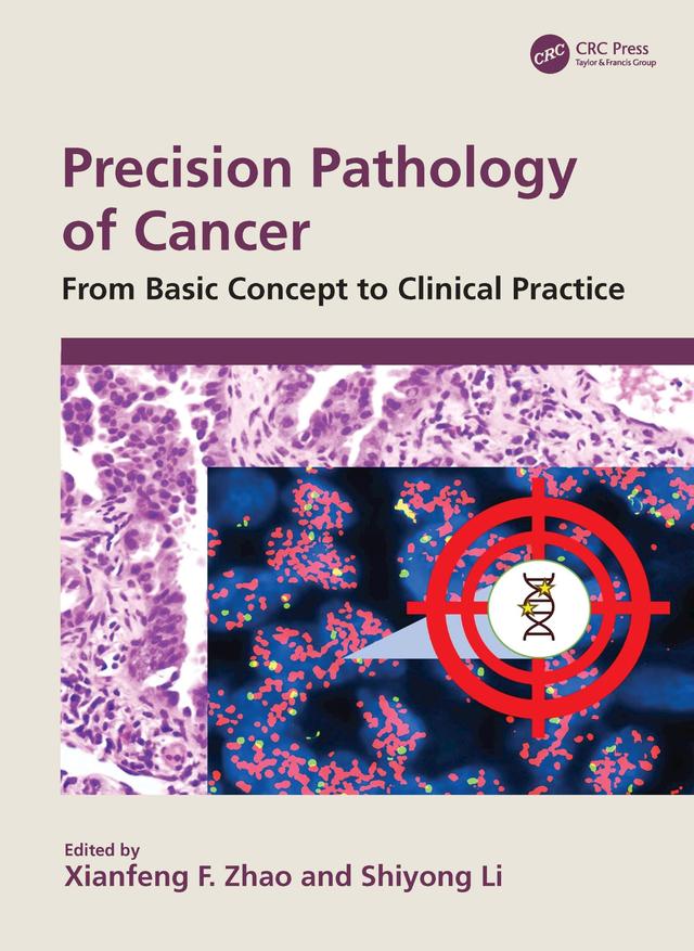Precision Pathology of Cancer by Shiyong Li, Xianfeng F. Zhao