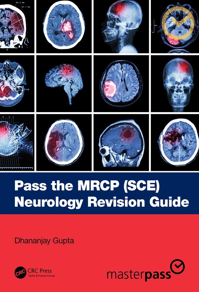 Pass the MRCP (SCE) Neurology Revision Guide by Dhananjay Gupta