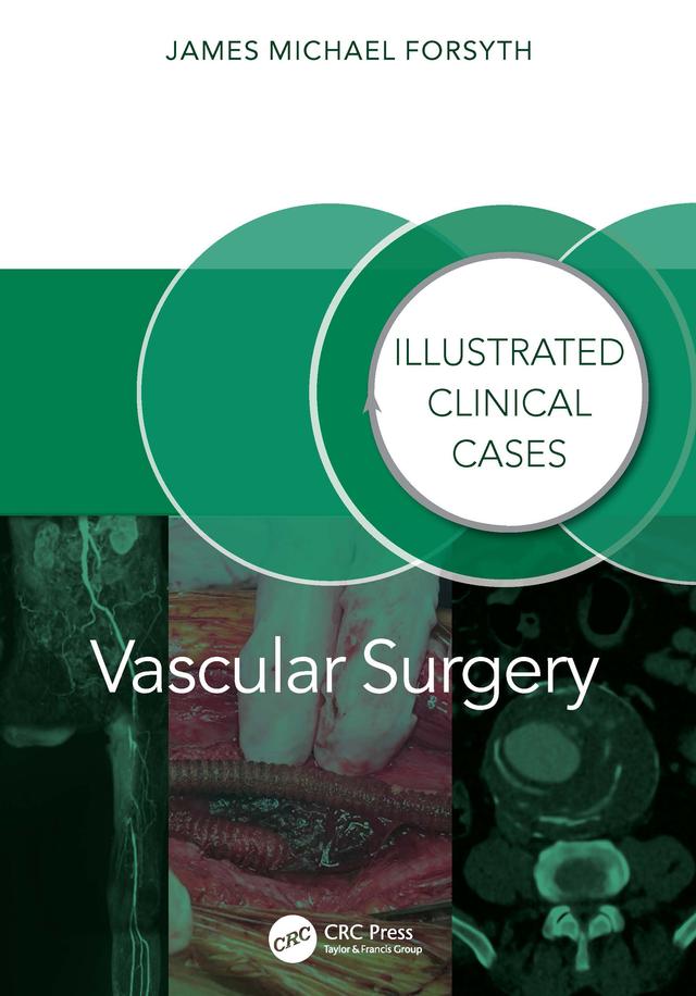 Vascular Surgery: by James Forsyth