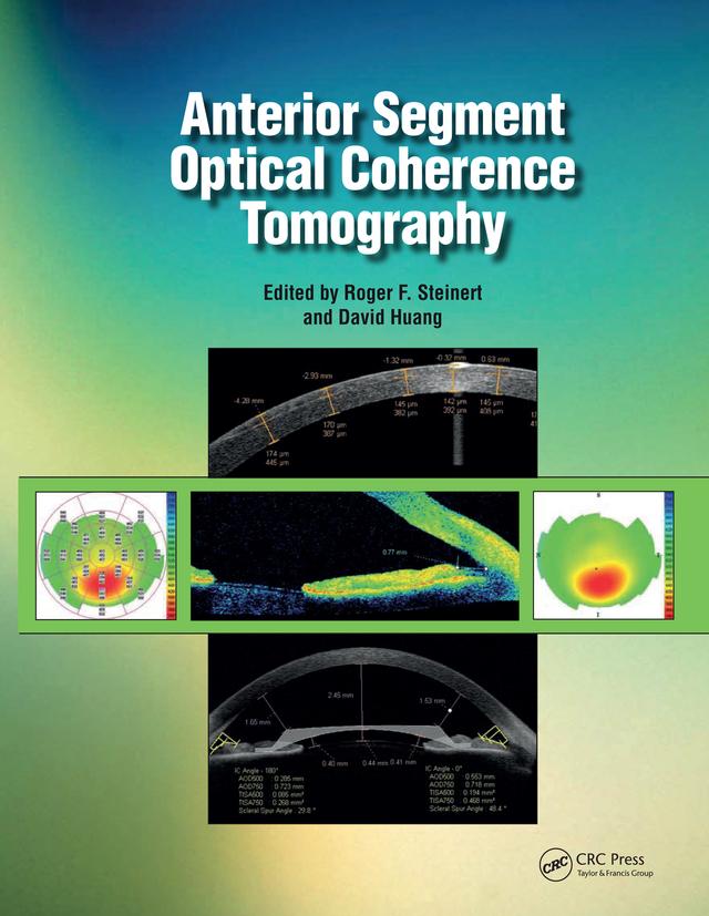 Anterior Segment Optical Coherence Tomography by David Huang, Roger Steinert
