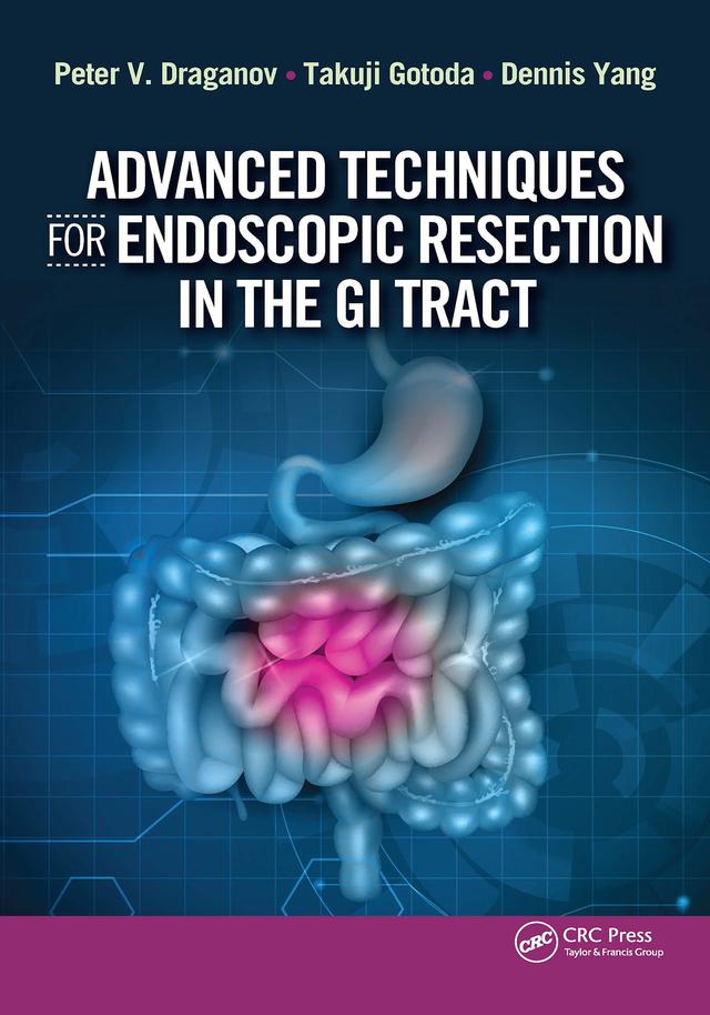 Advanced Techniques for Endoscopic Resection in the GI Tract by Dennis Yang, Peter Draganov, Takuji Gotoda