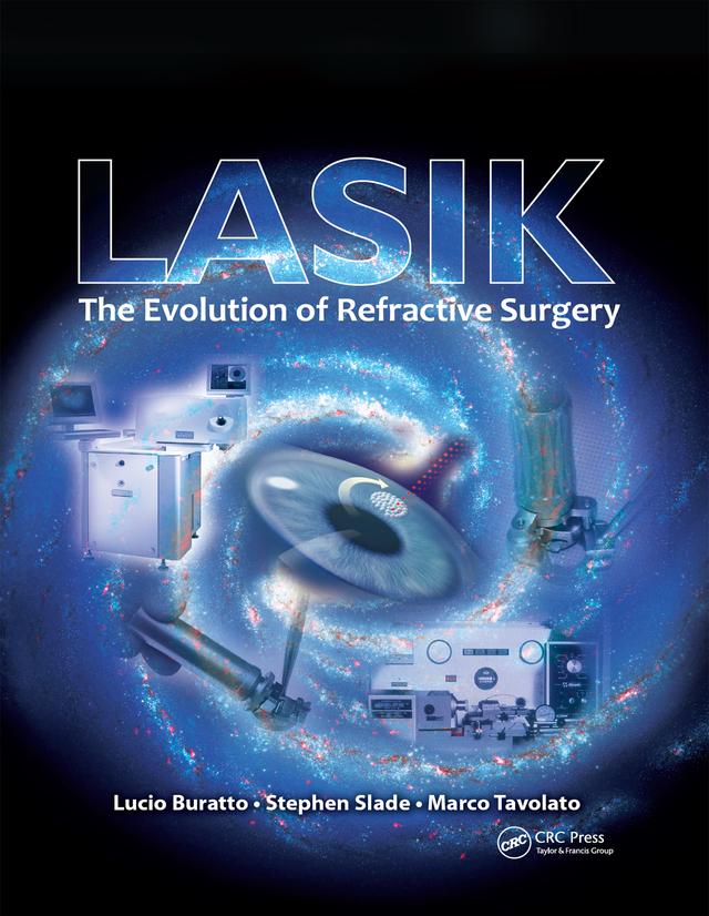 LASIK by Lucio Buratto, Marco Tavolato, Stephen Slade