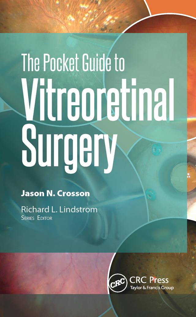 The Pocket Guide to Vitreoretinal Surgery by Jason Crosson