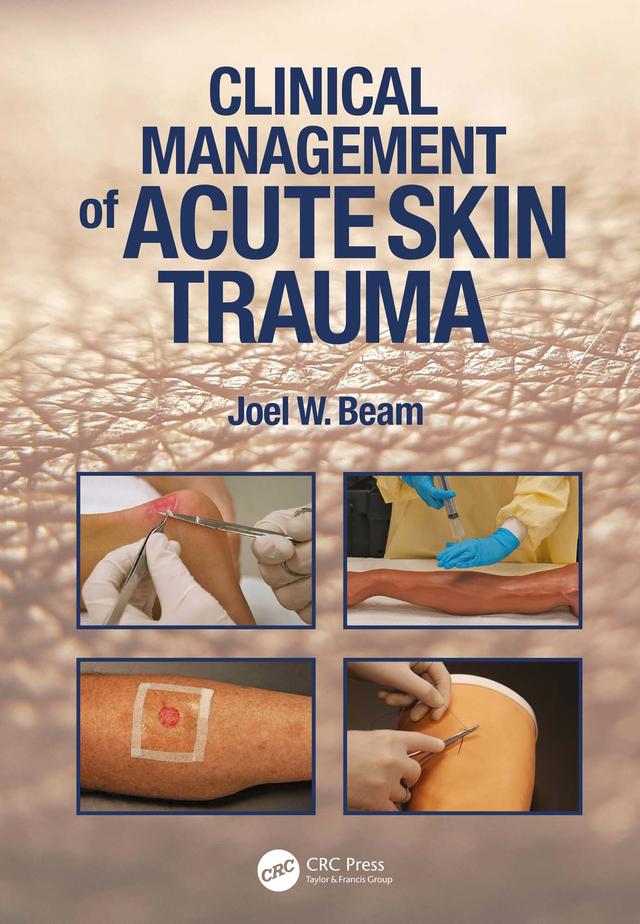 Clinical Management of Acute Skin Trauma by Joel W. Beam