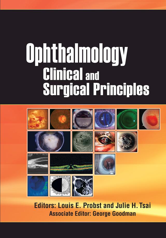 Ophthalmology by Julie Tsai, Louis Probst