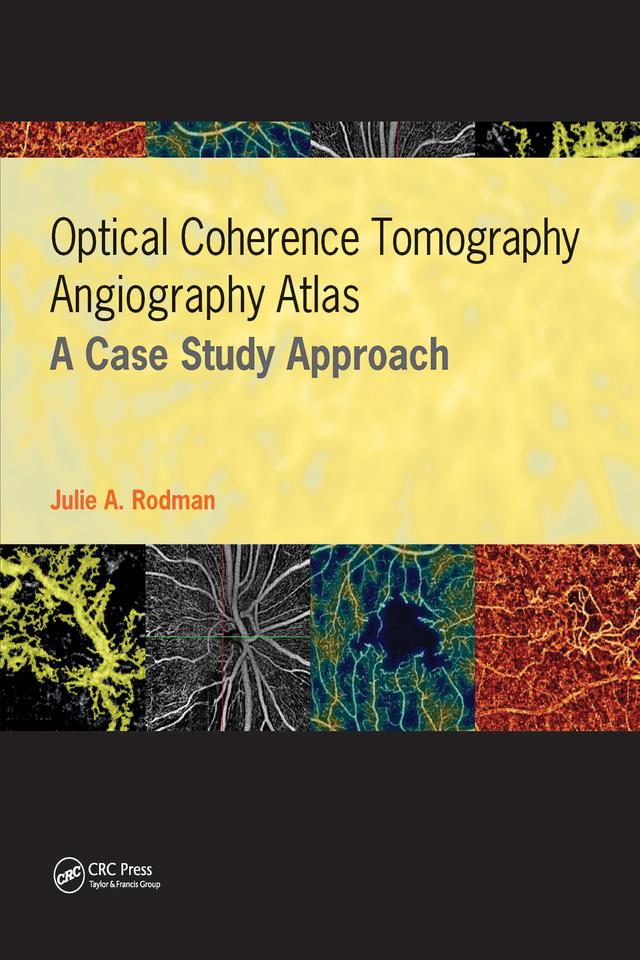 Optical Coherence Tomography Angiography Atlas by Dan Esmaili, Julie Rodman