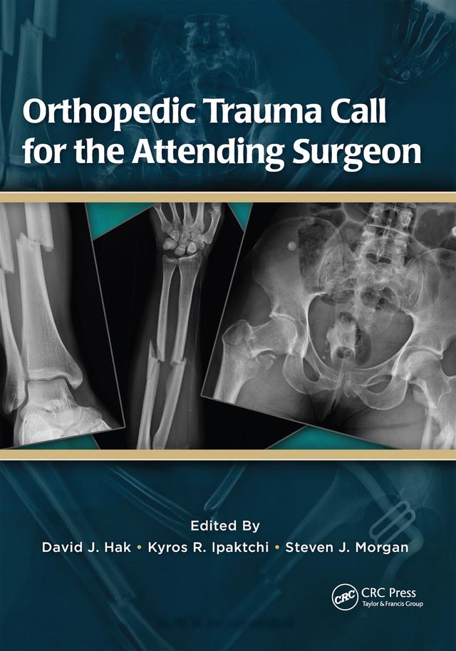 Orthopedic Trauma Call for the Attending Surgeon by David Hak, Kyros Ipaktchi, Steven Morgan