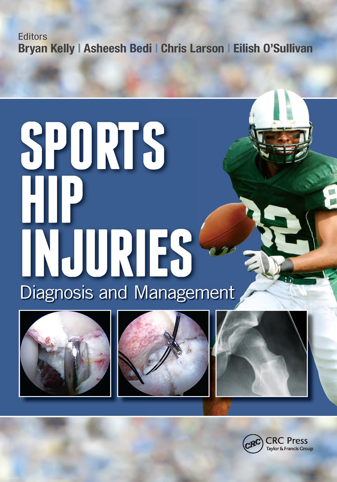 Sports Hip Injuries