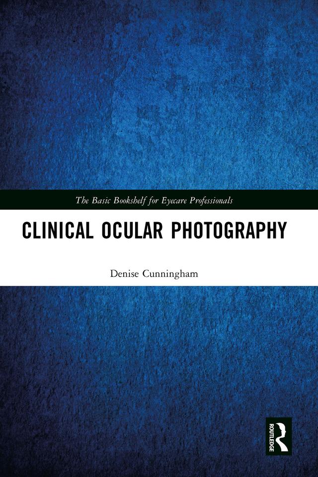 Clinical Ocular Photography by Denise Cunningham