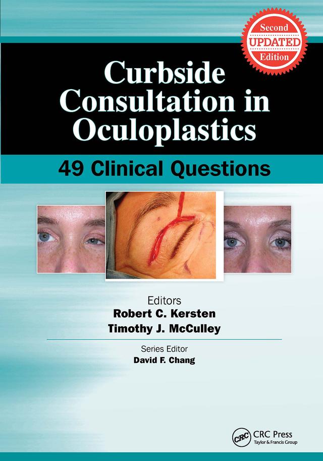 Curbside Consultation in Oculoplastics by Robert Kersten, Timothy McCulley