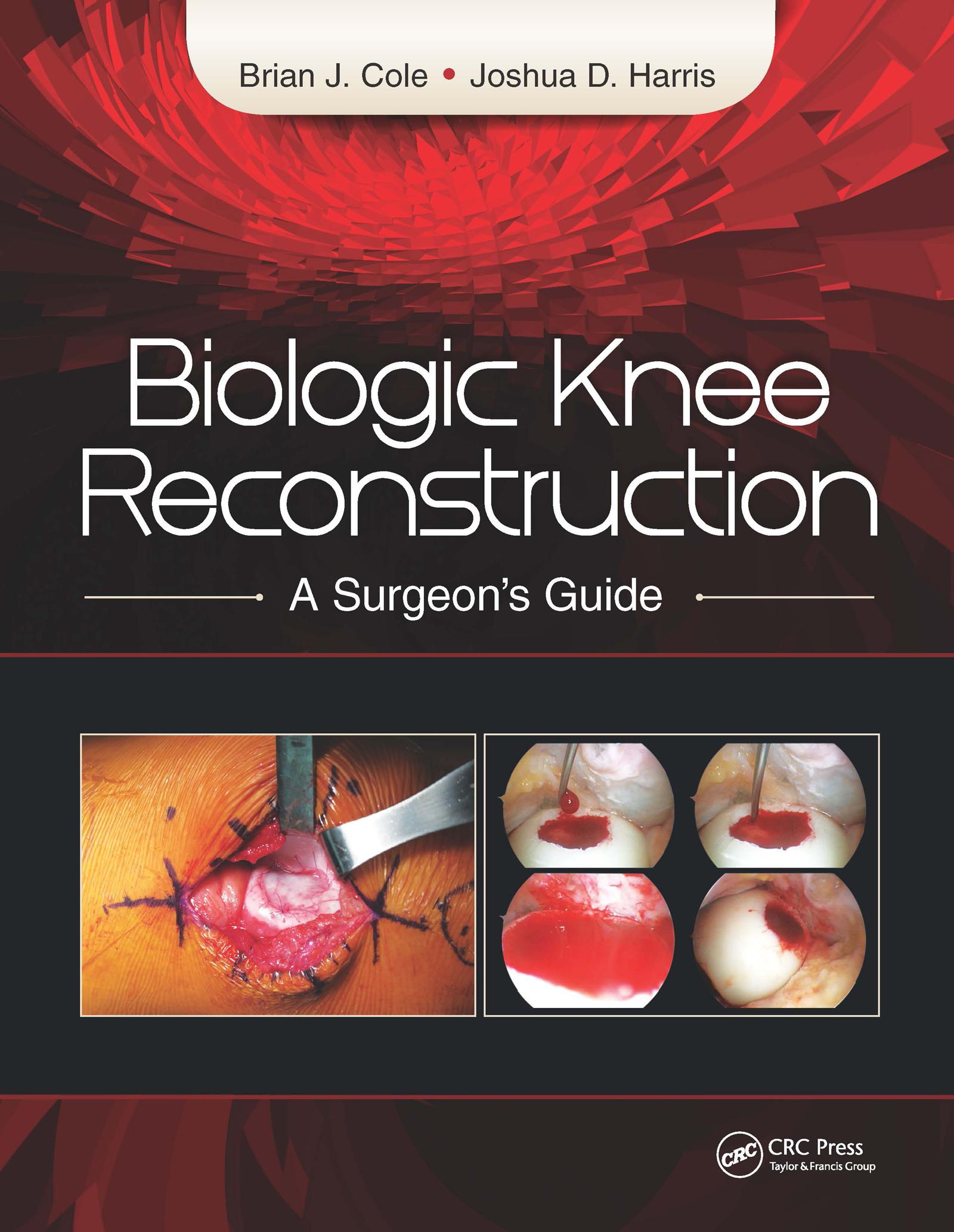 Biologic Knee Reconstruction
