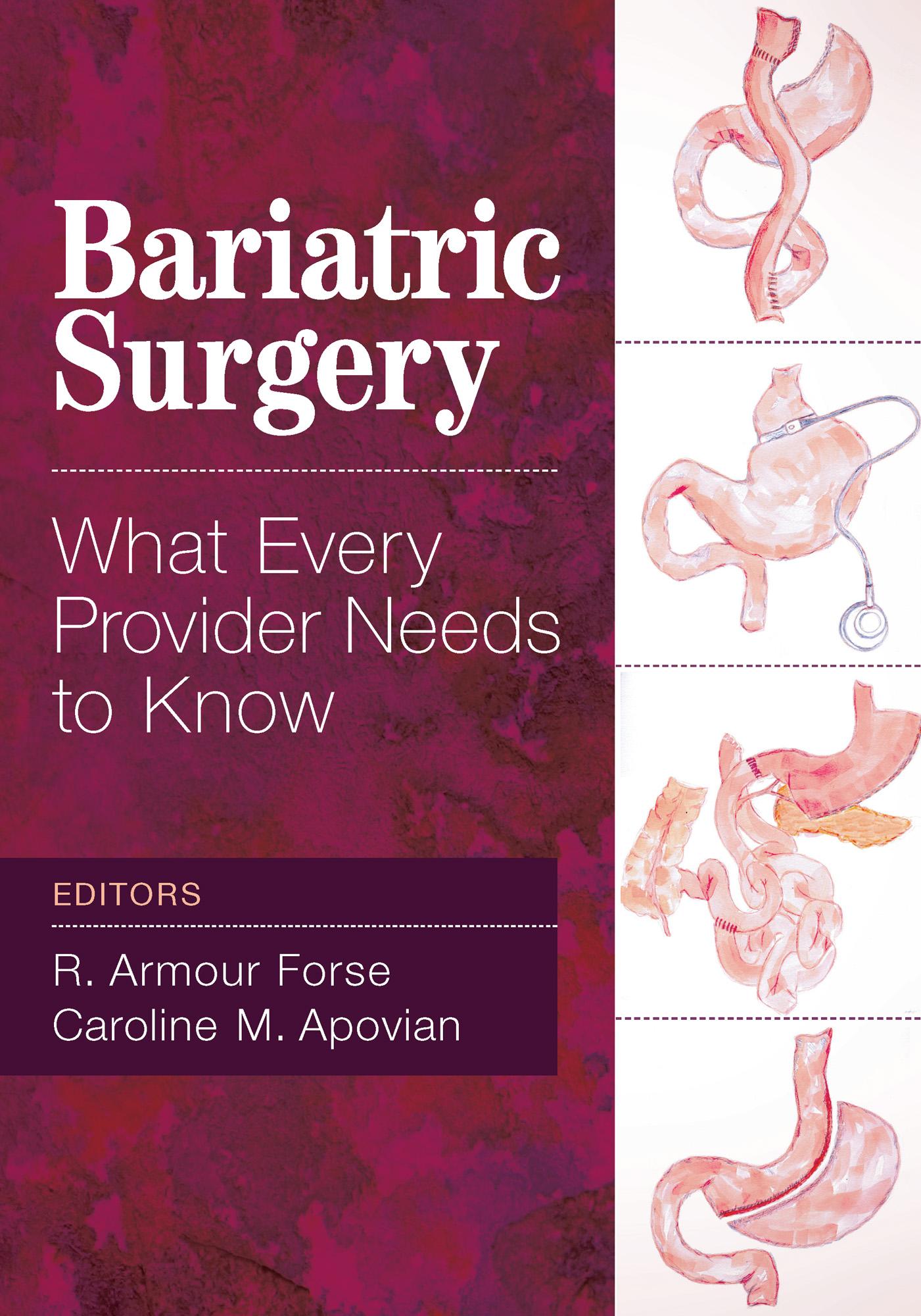 Bariatric Surgery