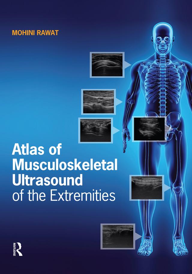 Atlas of Musculoskeletal Ultrasound of the Extremities by Mohini Rawat