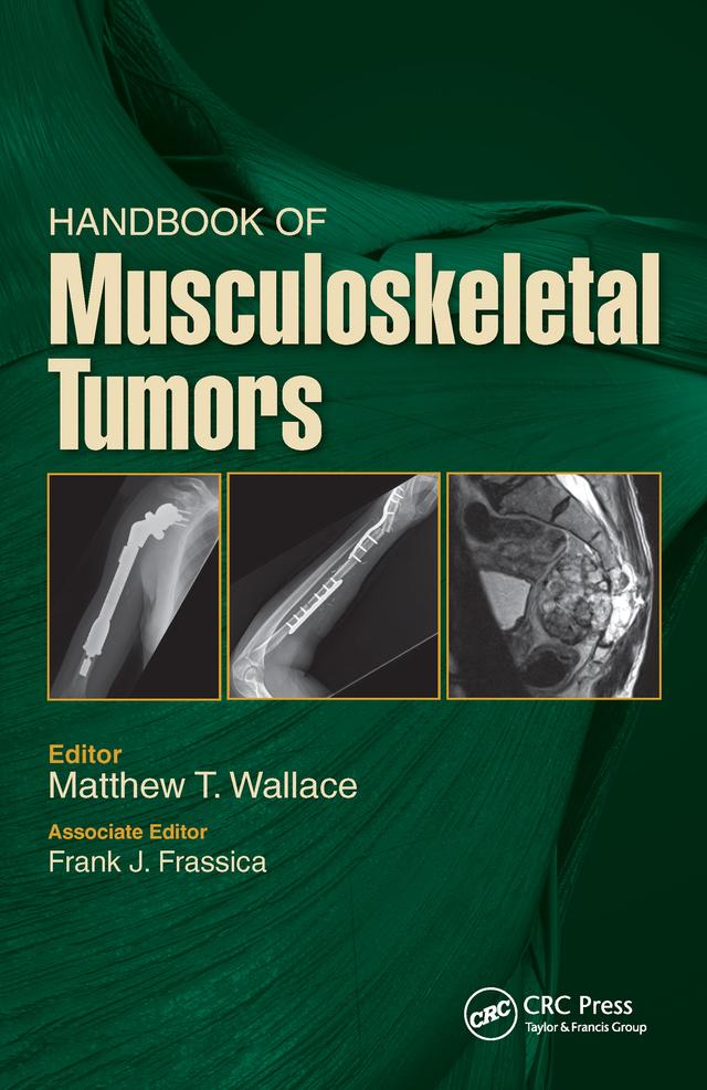Handbook of Musculoskeletal Tumors by Frank Frassica, Matthew Wallace