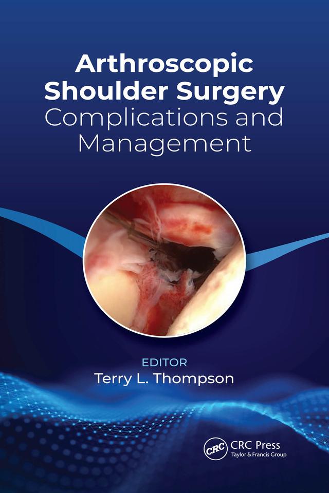Arthroscopic Shoulder Surgery by Terry Thompson