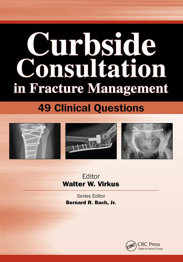 Curbside Consultation in Fracture Management by Walter Virkus