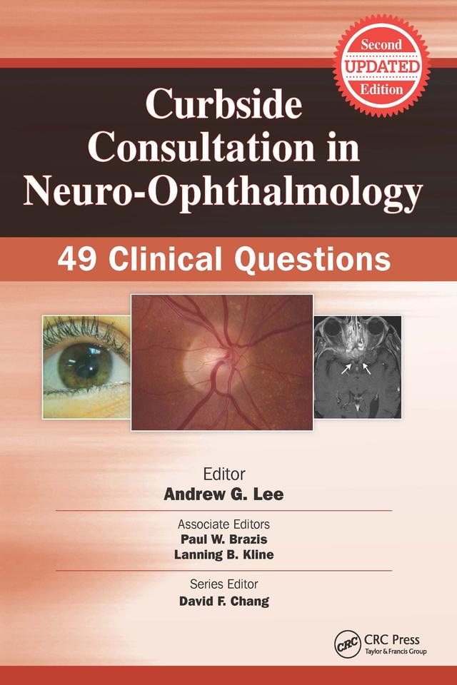 Curbside Consultation in Neuro-Ophthalmology by Andrew Lee