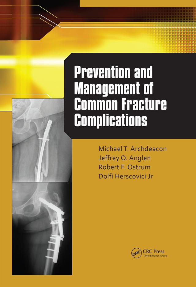 Prevention and Management of Common Fracture Complications by Dolfi Herscovici, Jeff Anglen, Michael Archdeacon, Robert Ostrum