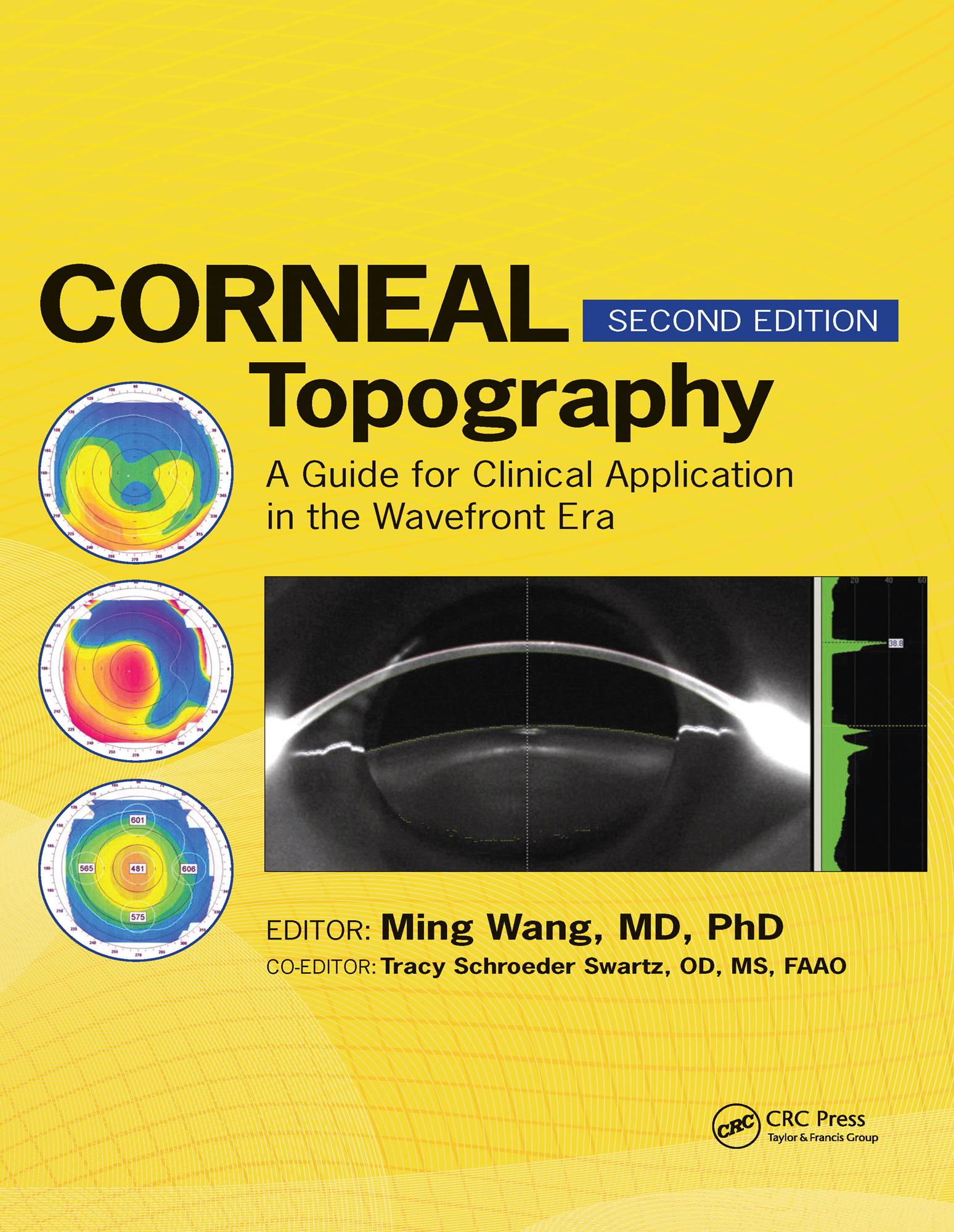 Corneal Topography