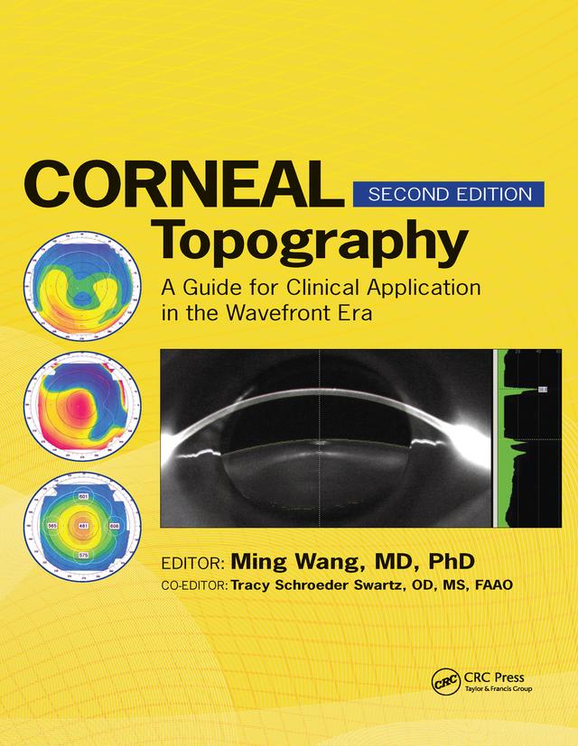 Corneal Topography by Ming Wang