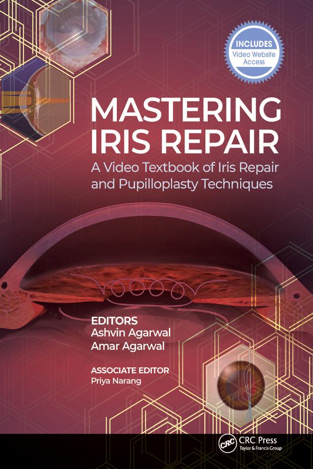 Mastering Iris Repair by Amar Agarwal, Ashvin Agarwal